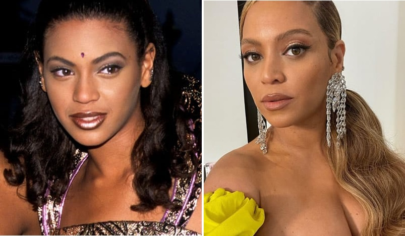 Бейонсе до и после пластики