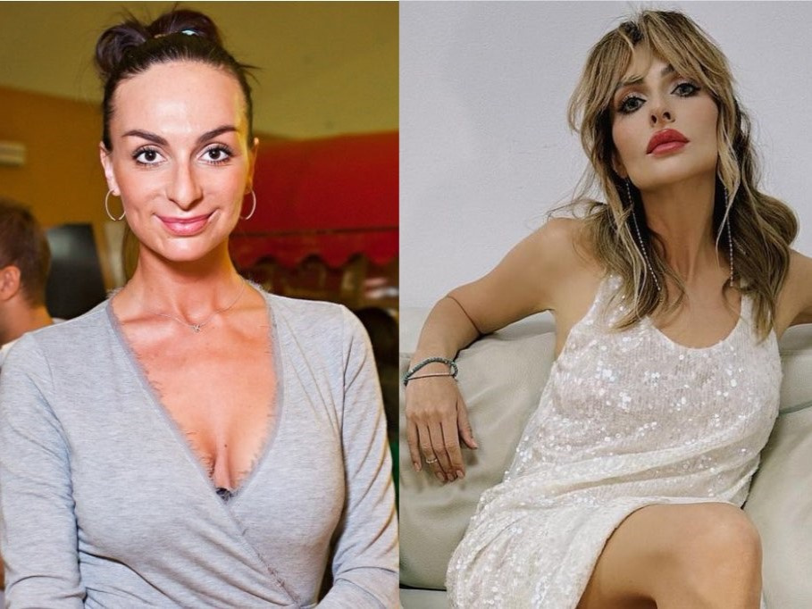 Екатерина Варнава до и после пластики