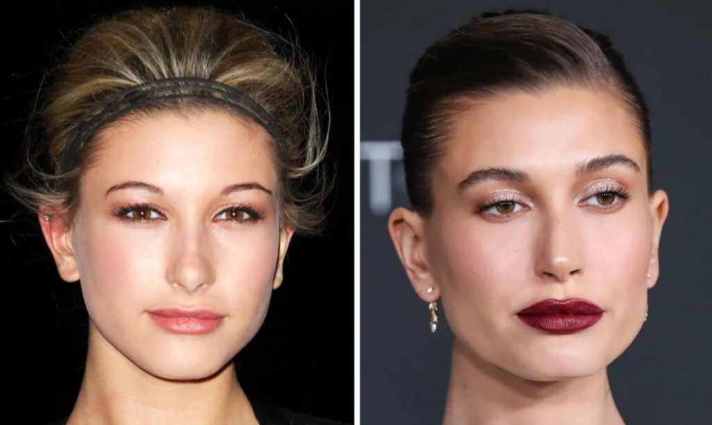 Хейли Бибер до и после пластики