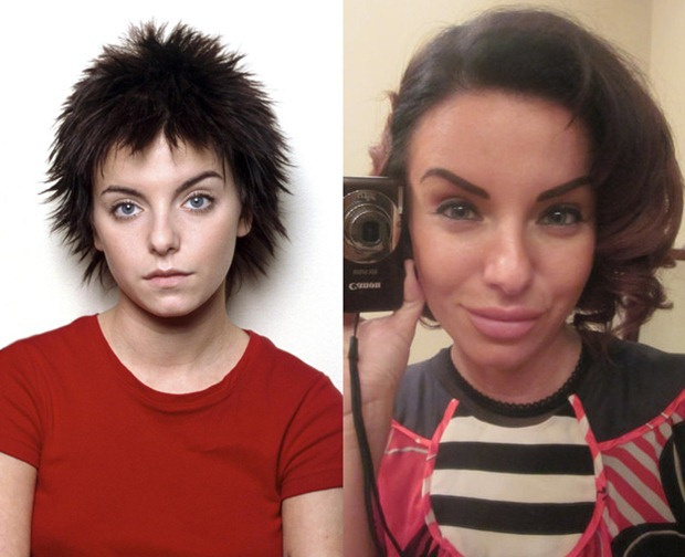Юлия Волкова до и после пластических операций