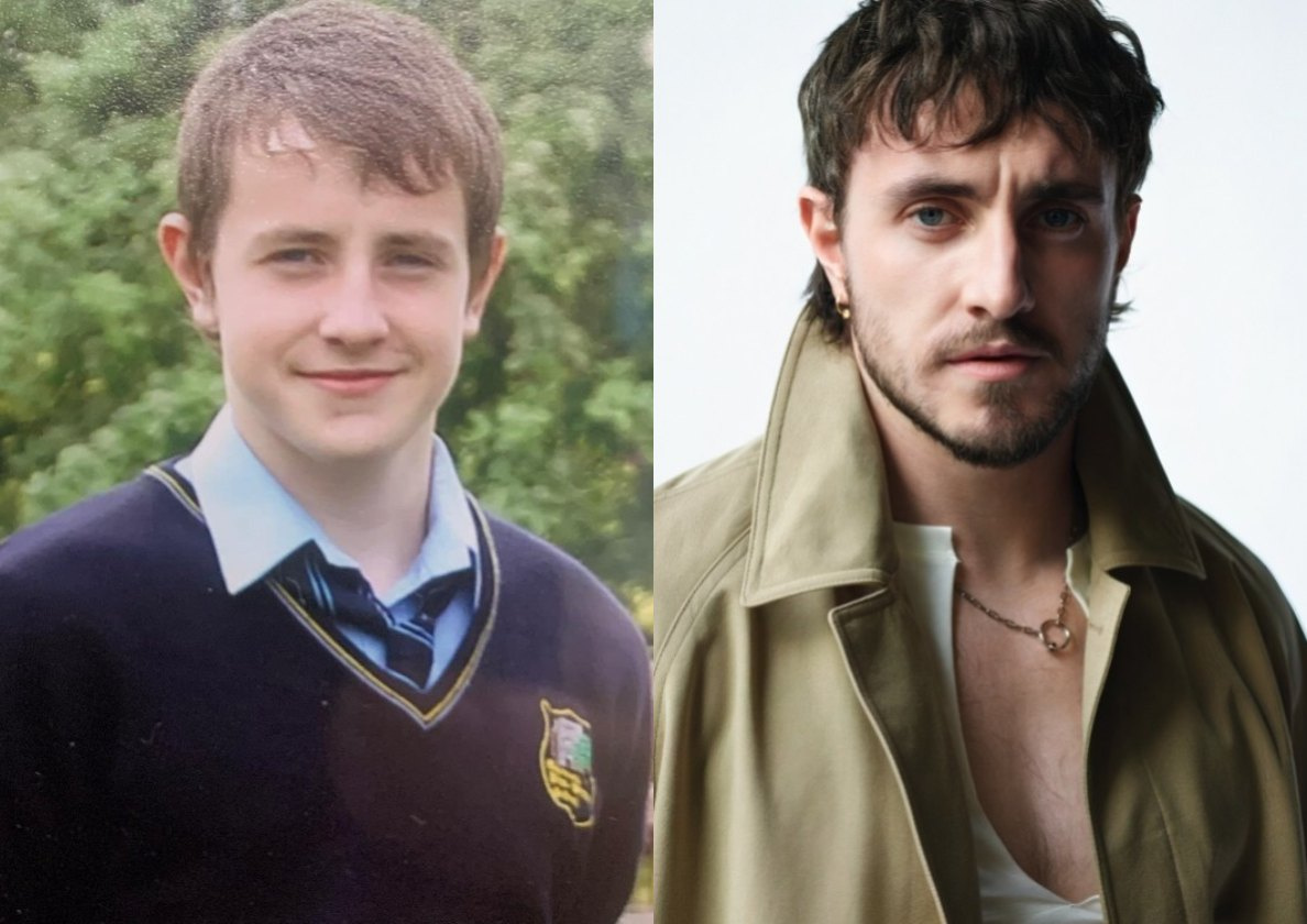 Пол Мескал до и после возможной пластики