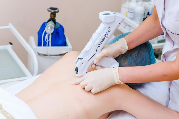 Карбокситерапия: как углекислый газ помогает коже выглядеть моложе