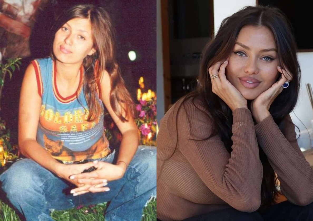 Виктория Боня до и после пластики