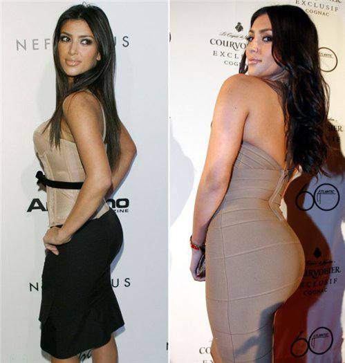 Фото: Ким Кардашьян до и после