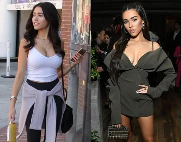 Фото: Мэдисон Бир до и после пластики