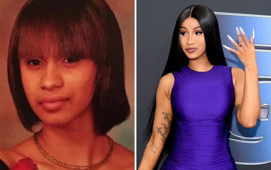 Фото: Карди Би до и посл пластики