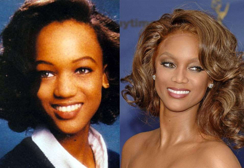 Тайра Бэнкс до и после ринопластики