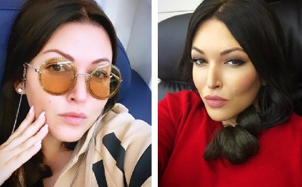 Дубцова до и после пластики